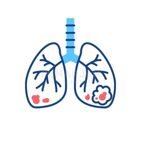 best-lung-cancer-treatment-hospitals-in-hyderabad-big-0