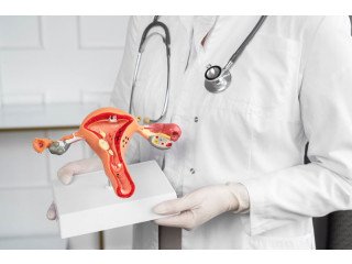 Uterine Fibroid Treatment In Delhi, India