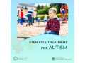 stem-cell-treatment-for-autism-in-india-small-0