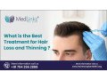 what-is-the-best-treatment-for-hair-loss-and-thinning-small-0