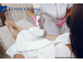 experience-total-smoothness-full-body-laser-hair-removal-at-komsoderma-delhi-small-0