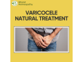 the-best-varicocele-treatment-and-natural-treatment-without-surgery-small-0