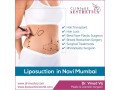 transform-your-body-with-liposuction-by-dr-vinod-vij-in-navi-mumbai-small-0