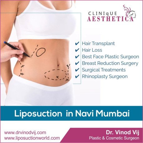 transform-your-body-with-liposuction-by-dr-vinod-vij-in-navi-mumbai-big-0