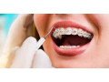 best-dental-clinic-in-sarvapriya-vihar-comprehensive-care-for-all-ages-small-1