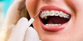 best-dental-clinic-in-sarvapriya-vihar-comprehensive-care-for-all-ages-big-1