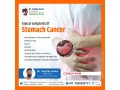 best-stomach-cancer-surgeon-in-dehradun-dr-sachin-arora-small-1