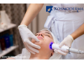 laser-skin-rejuvenation-treatment-in-bangalore-effective-fractional-skin-rejuvenation-at-kosmoderma-small-0