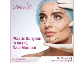 Meet Dr. Vinod Vij: Premier Plastic Surgeon in Vashi, Navi Mumbai