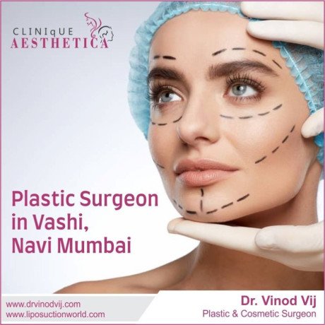 meet-dr-vinod-vij-premier-plastic-surgeon-in-vashi-navi-mumbai-big-0