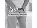 best-varicocele-treatment-naturally-without-surgery-small-0