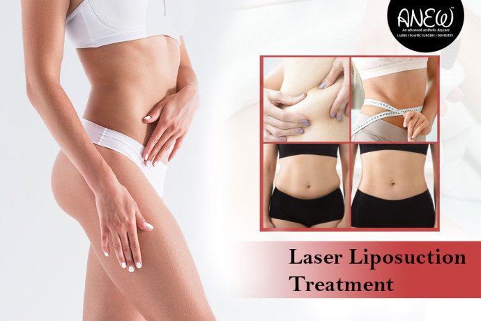 improve-your-body-with-laser-liposuction-at-anew-cosmetic-clinic-big-0