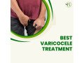 varicocele-management-with-natural-remedies-a-holistic-approach-small-0