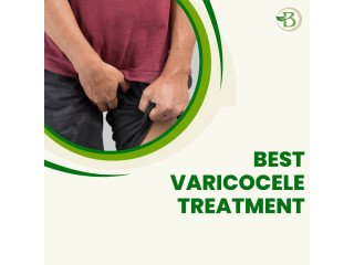 Varicocele Management with Natural Remedies: A Holistic Approach