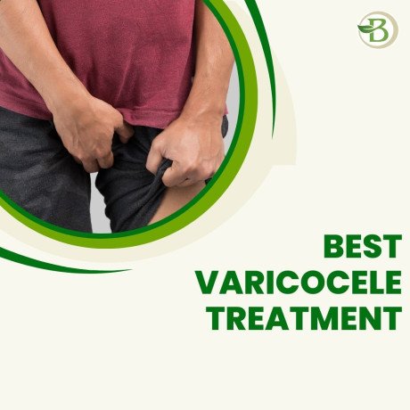 varicocele-management-with-natural-remedies-a-holistic-approach-big-0