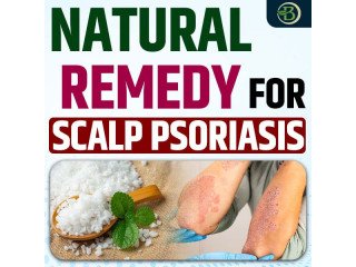 Natural Remedy for Scalp Psoriasis: A Guide to Permanent Solutions and Care