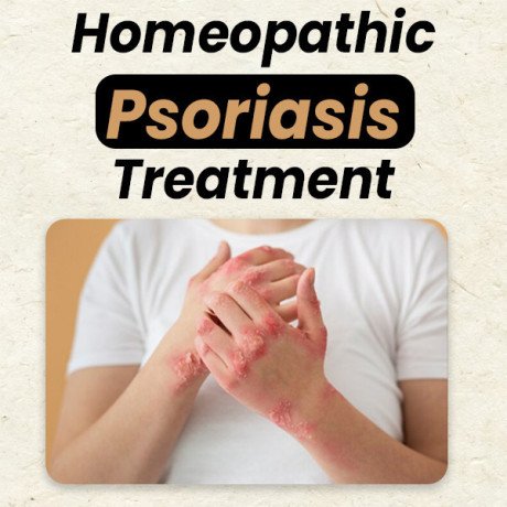 permanent-solution-for-psoriasis-explore-natural-approaches-that-work-big-0