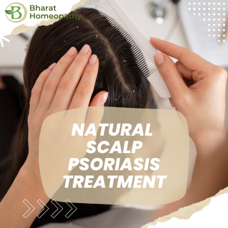 permanent-solution-for-psoriasis-natural-scalp-psoriasis-treatments-big-0