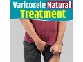 best-varicocele-natural-treatment-cure-varicocele-without-surgery-bharat-homeopathy-small-0