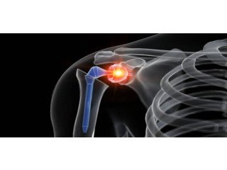 Best Orthopedic Doctor in Bangalore Near Me - Knee Replacements Doctors