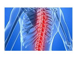 Spine Specialist Doctor In Delhi-Dr. Khera's Wellness Clinic