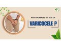 effective-non-surgical-varicocele-treatment-at-bharat-homeopathy-small-0