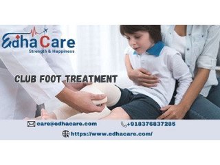 Best Clubfoot Treatment In India