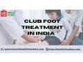 effective-clubfoot-treatment-in-india-at-low-cost-small-0