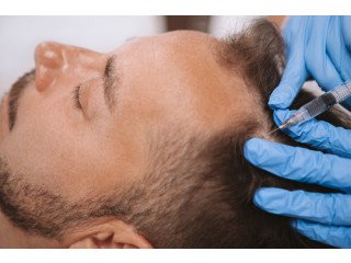 Best Hair transplant correction in Surat | RQC