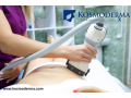 fat-freezing-treatment-coolsculpting-clinic-in-delhi-body-contouring-at-kosmoderma-small-0