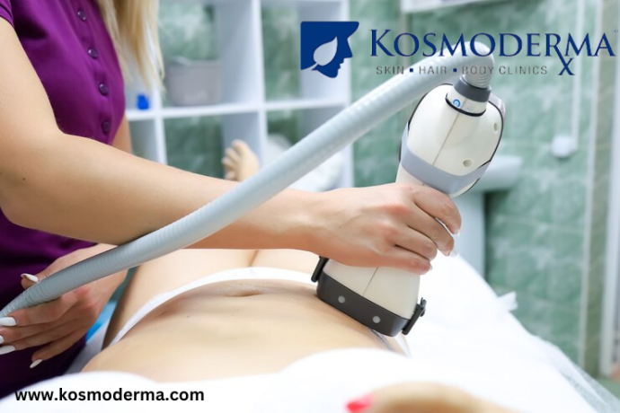 fat-freezing-treatment-coolsculpting-clinic-in-delhi-body-contouring-at-kosmoderma-big-0