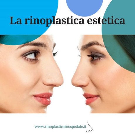 rinoplastica-in-italia-big-0