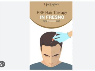 Prp Hair Therapy Fresno