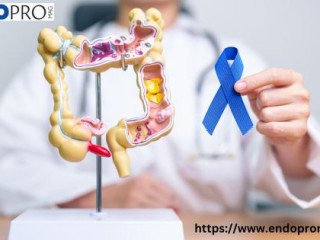 modern-gastrointestinal-disorders-treatment-for-faster-recovery