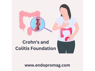 The Crohn's and Colitis Foundation Fight for a Cure