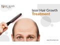 plasma-rich-platelet-therapy-for-hair-loss-fresno-small-0