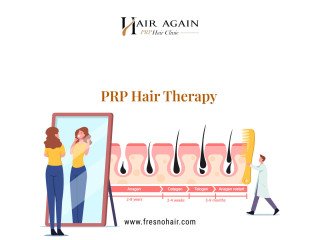 Platelet Rich Plasma Hair Therapy in Fresno.