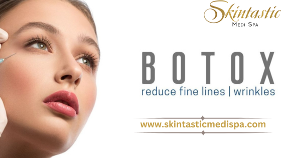 botox-in-riverside-ca-for-wrinkle-free-skin-big-0