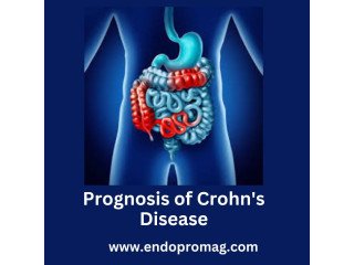 Improving the Prognosis of Crohn's Disease Through Diagnosis
