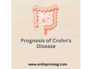 Navigating the Prognosis of Crohn's Disease