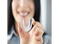 best-dental-mouthguard-treatment-in-dubai-uae-small-0