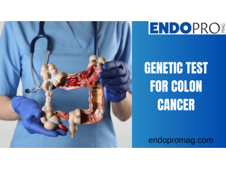 Exploring the Role of Genetic Testing in Colon Cancer Prevention