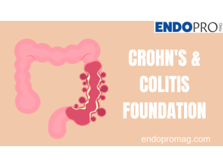 Latest News and Updates from the Crohn's and Colitis Foundation